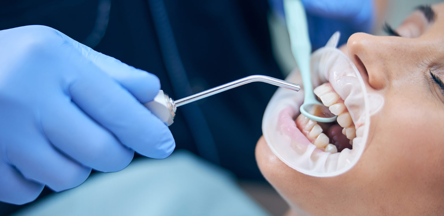 dental-spa-image