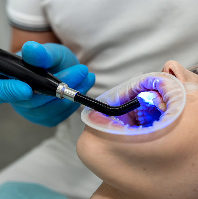 Laser Dentistry FAQs