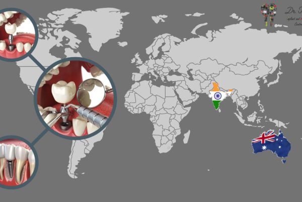 Dental Implants in Australia vs India