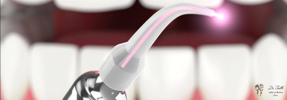 Is Laser Dentistry Worth It