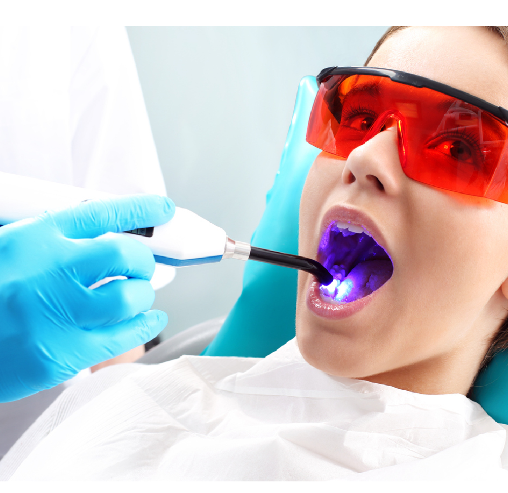Laser Treatment