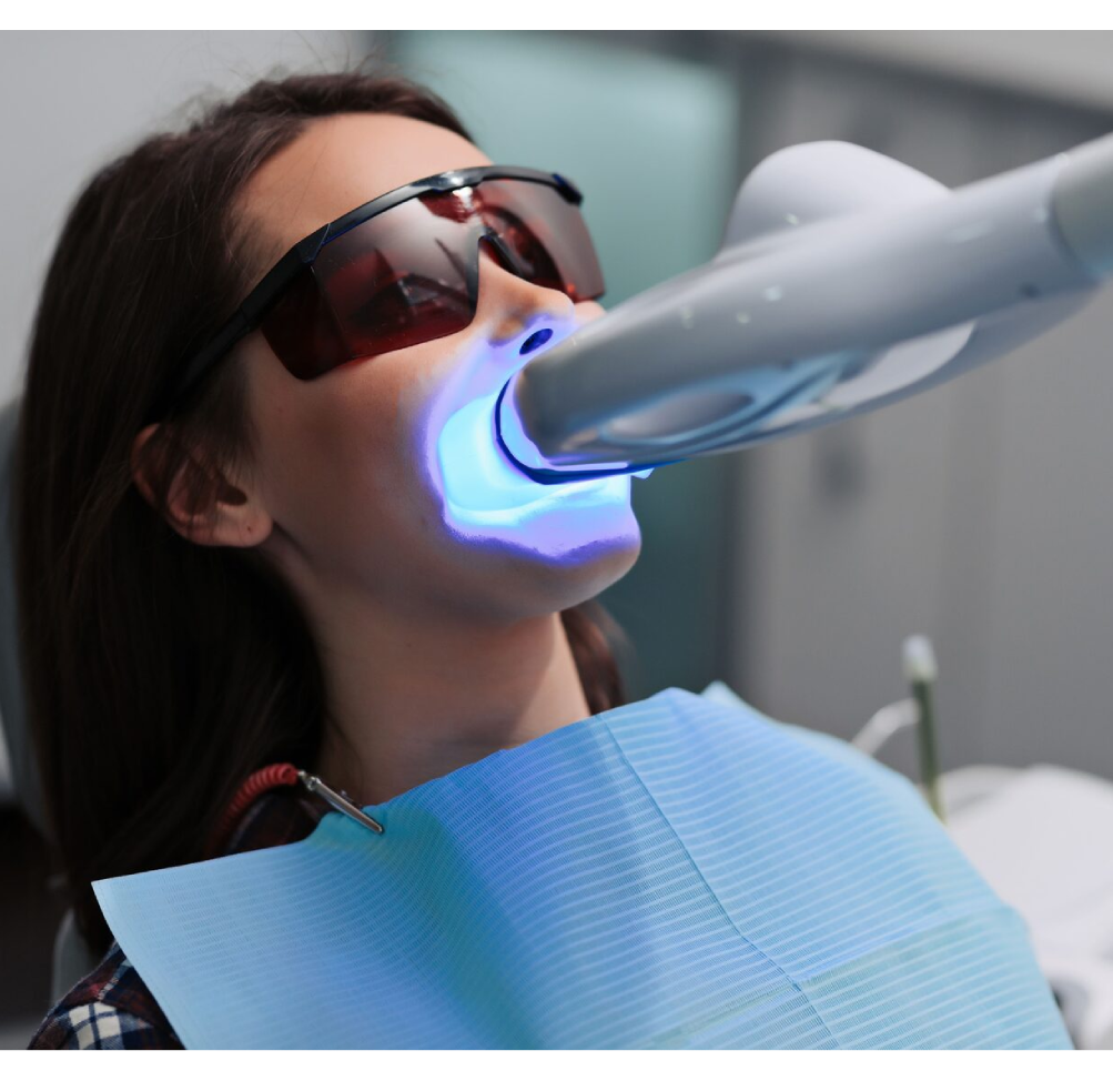 Teeth Polishing