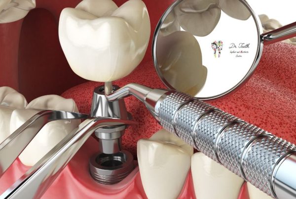 Dental Surgery Types
