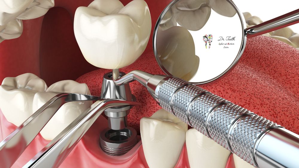 Know the Dental Surgery Types Before You Visit the Dentist