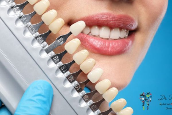 Different Types of Cosmetic Dentistry Treatments