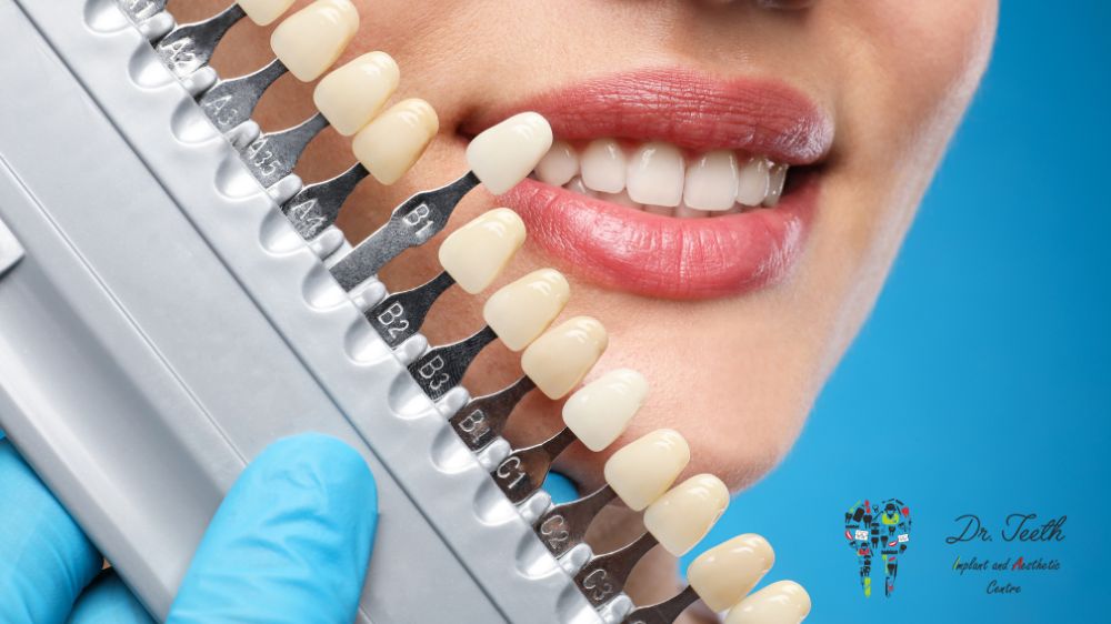 Exploring the Different Types of Cosmetic Dentistry Treatments