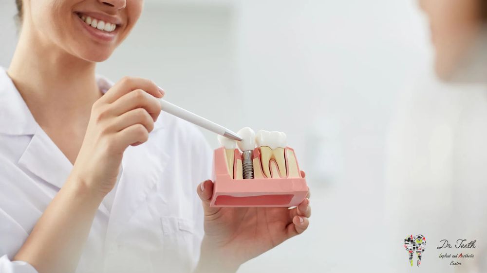 The Ultimate Guide to Dental Implant Aftercare