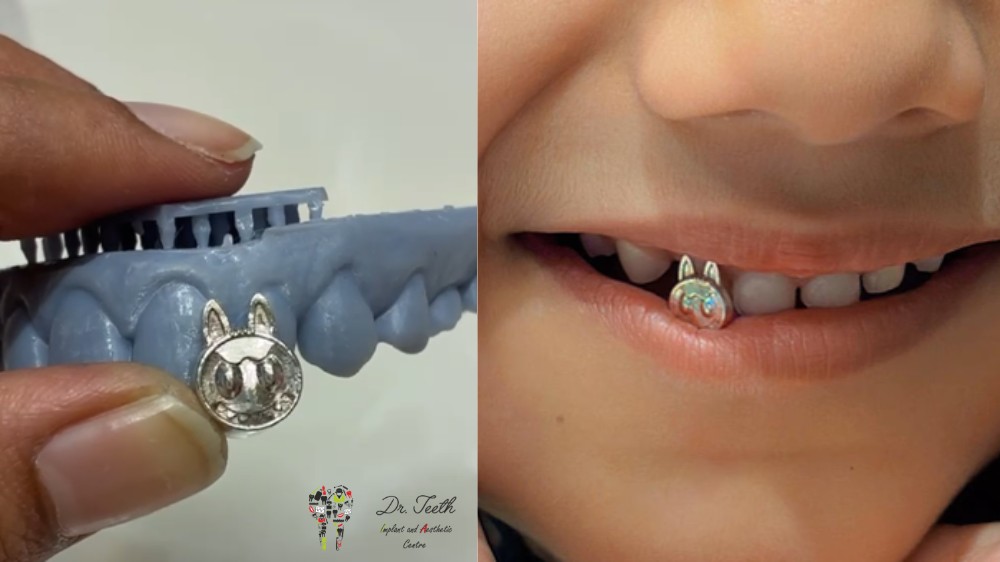 Teeth Grillz From Classic Gold & Silver to the New Labubu Trend