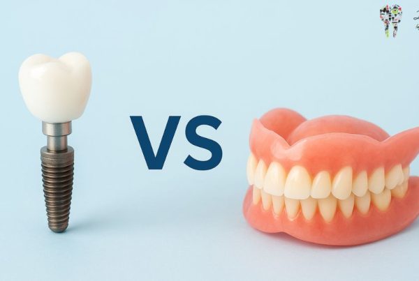 Dental Implants vs. Dentures: Which One Fits Your Lifestyle