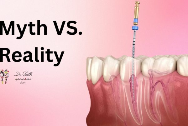root canal treatment myth and reality