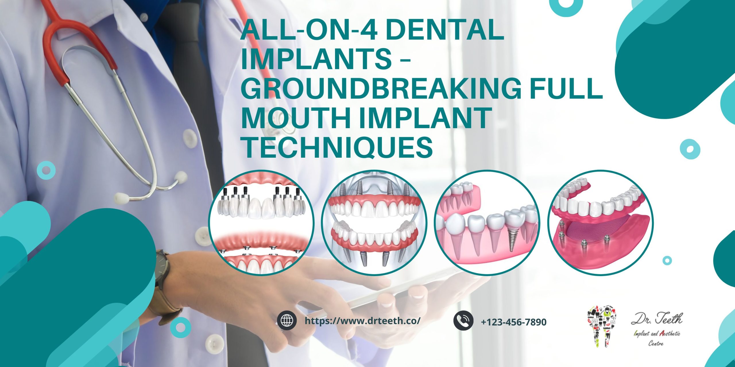 All-on-4 Dental Implants Abroad
