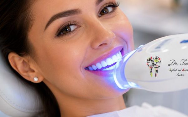 Benefits of Instant Teeth Whitening Before Weddings and Special Events