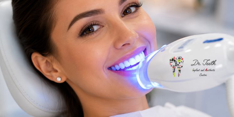 Benefits of Instant Teeth Whitening Before Weddings and Special Events
