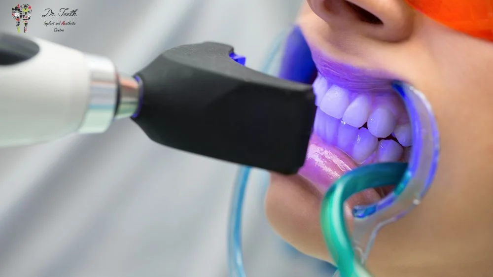 Instant Teeth Whitening Overseas: Is It Worth the Trip?