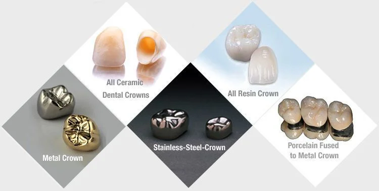 Understanding the Different Types of Dental Crowns