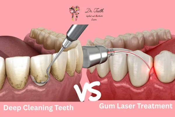 Laser Gum Treatment vs Deep Cleaning: What’s the Difference and Which One Do You Need?