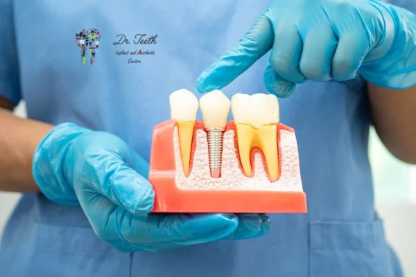 Is a Root Canal Considered Surgery? Everything You Need to Know